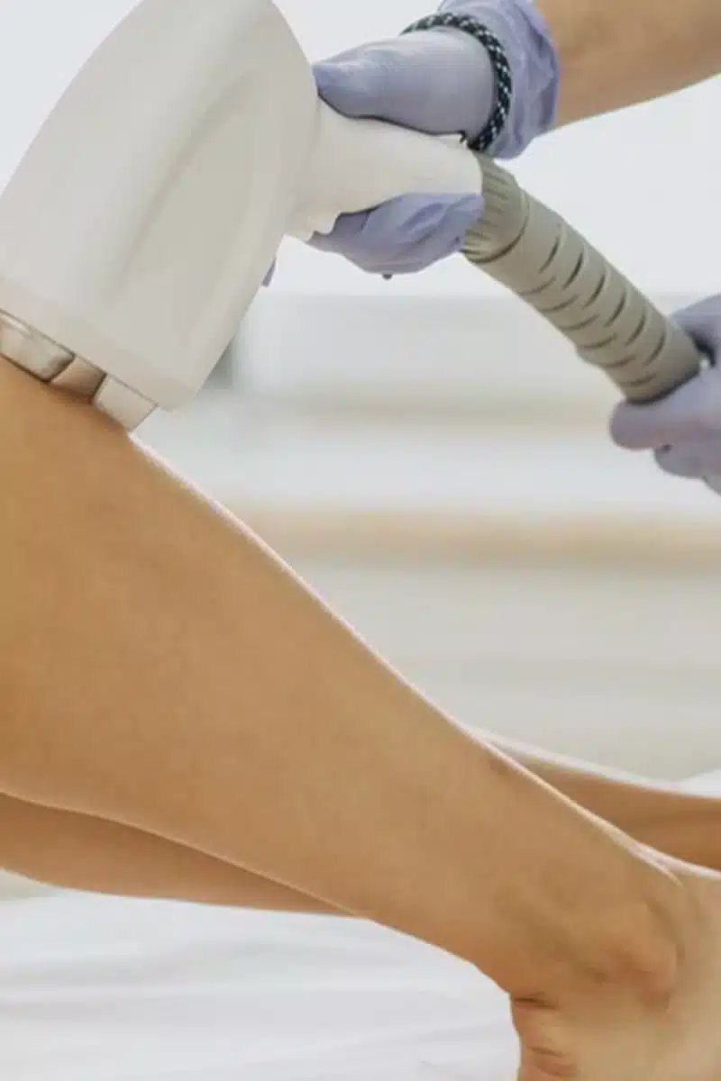 Depilación con láser 2 depilacion laser 1